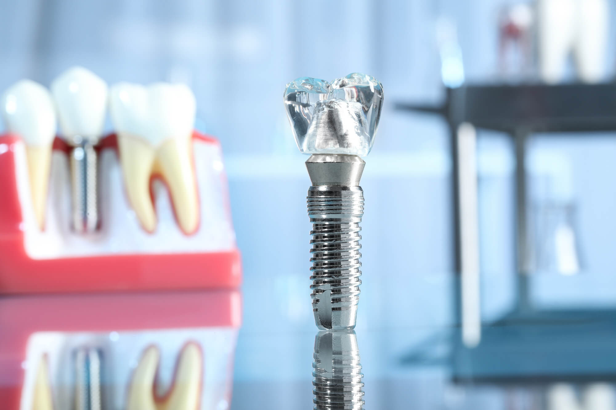 Dental Implant Myths Debunked