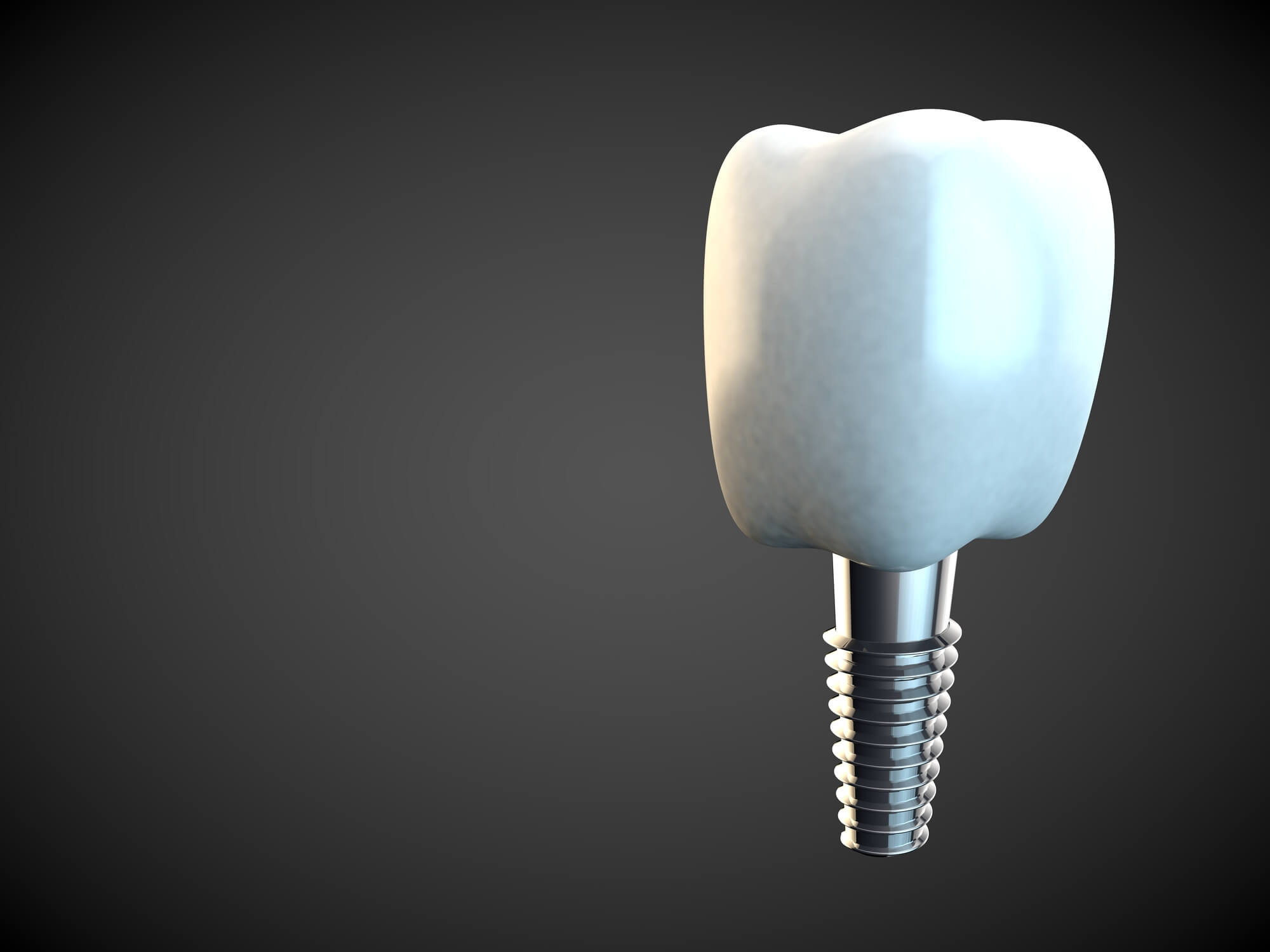 How Long Will A Dental Implant Procedure Take