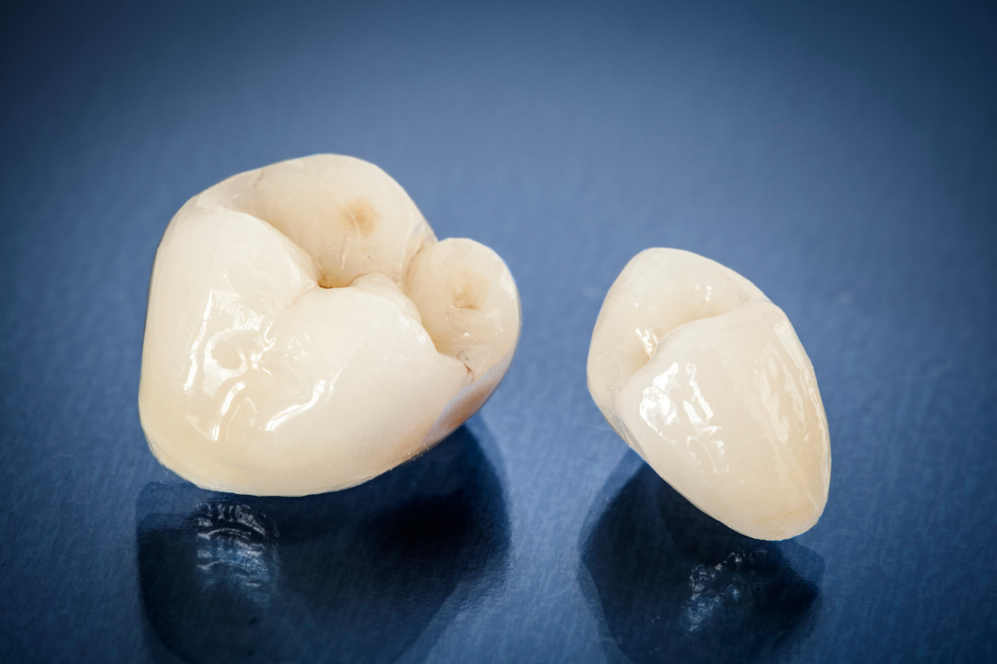 dental crowns frequently asked questions
