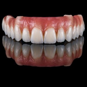 zirconia denture