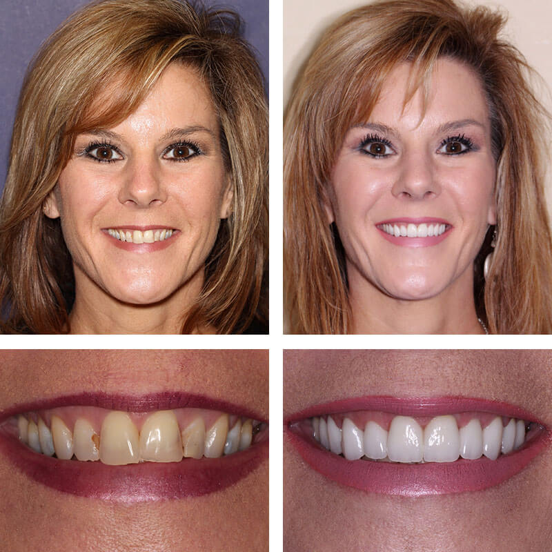 Smile transformation from PGA Dentistry