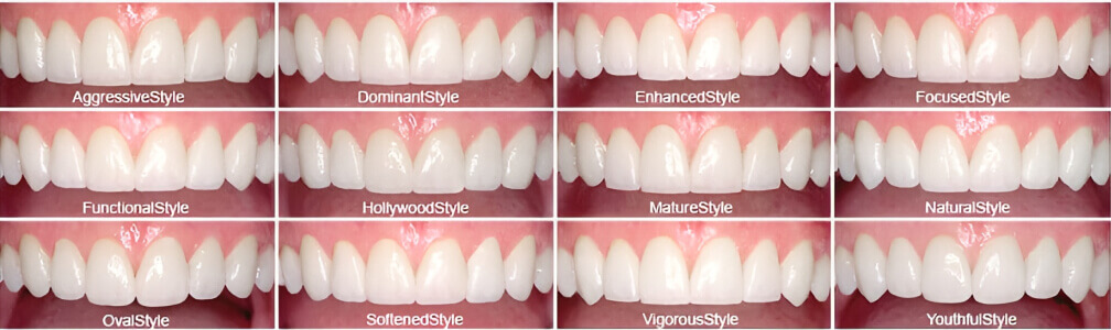 A collage of 12 types of teeth and gums during a smile evaluation.