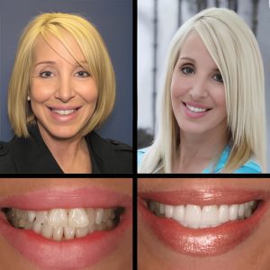 Cosmetic Dentistry