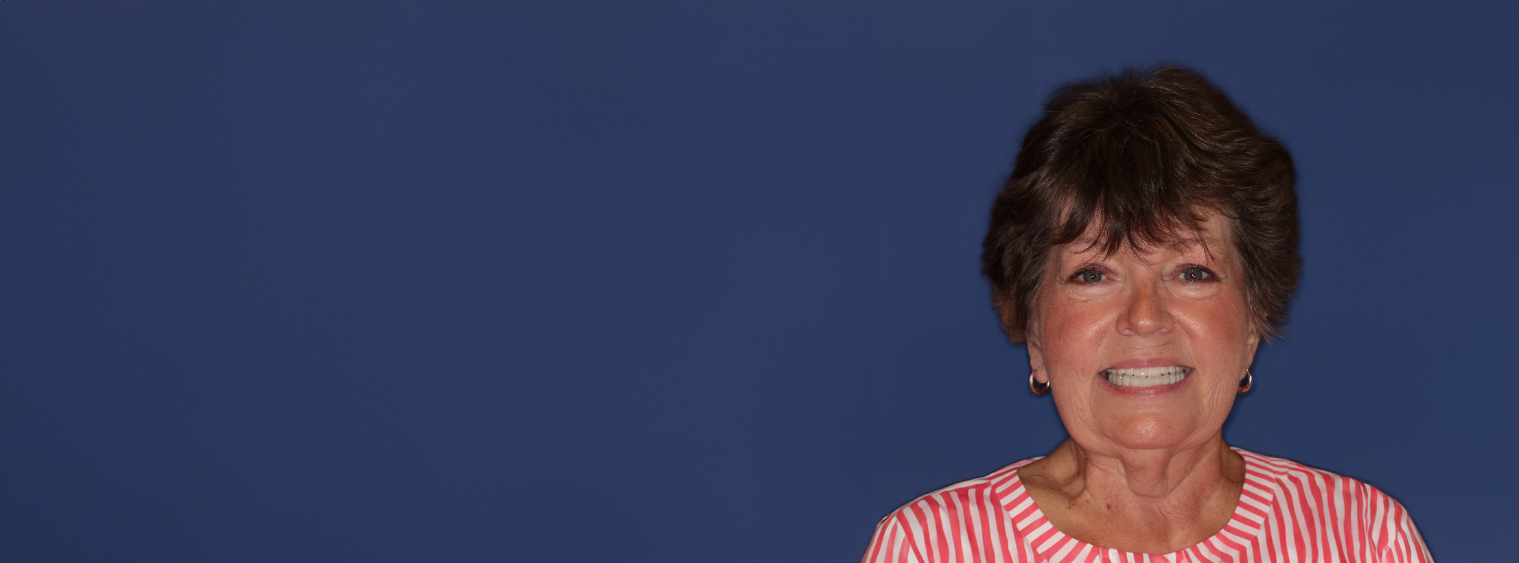 Smiling woman in striped shirt showcasing new porcelain bridgework after full mouth dental rehabilitation at PGA Dentistry.