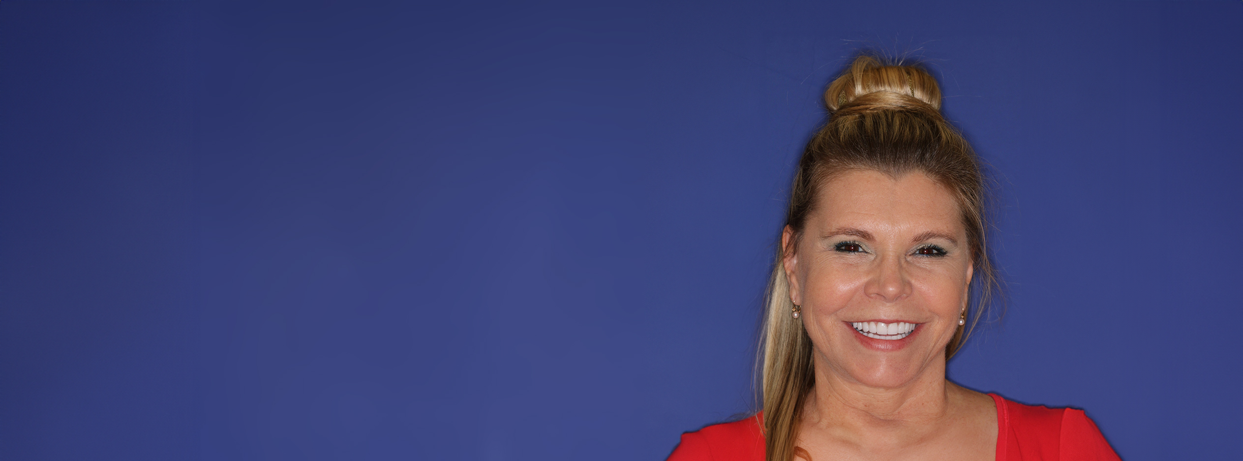 Deborah smiling confidently after her smile makeover with porcelain veneers, showcasing a bright and youthful appearance against a blue background.