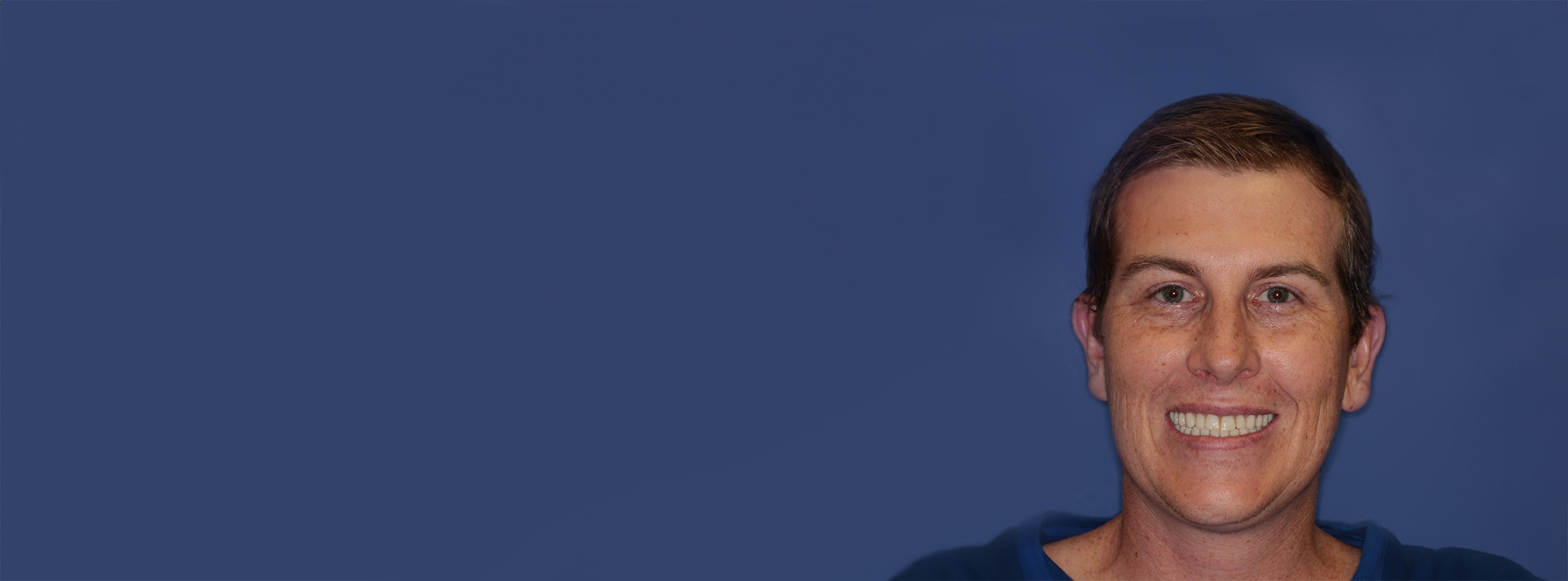 John smiling after full mouth reconstruction with porcelain crowns, showcasing improved dental aesthetics and function.